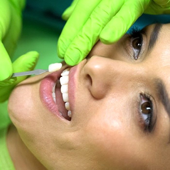 cosmetic dentist in Grove City placing a veneer on a woman’s tooth