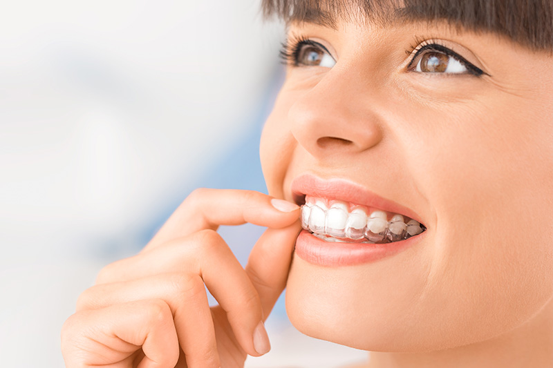 Invisalign in Grove City